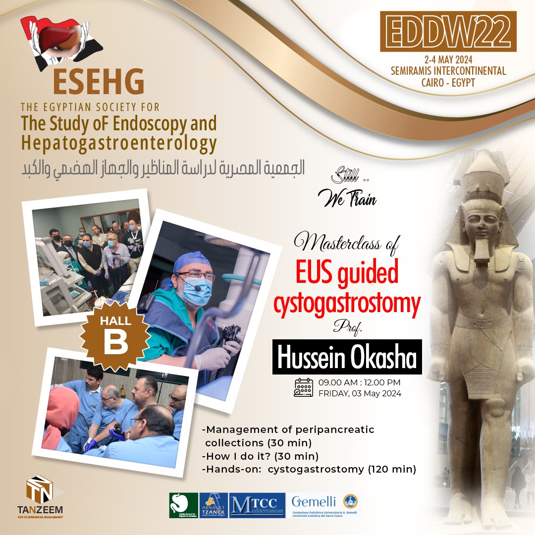 EUS Guided Cystogastrostomy